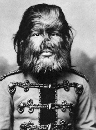 Фёдор Евтищев (1868-1904) — «мальчик с собачьей мордой», знаменитый актёр цирка Барнума.